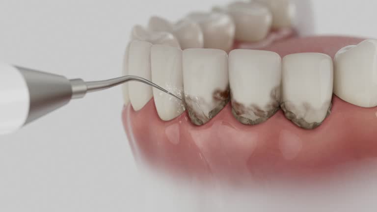 Reliable Dental Implants contractor in Centerburg, OH by Smile Center Dentistry